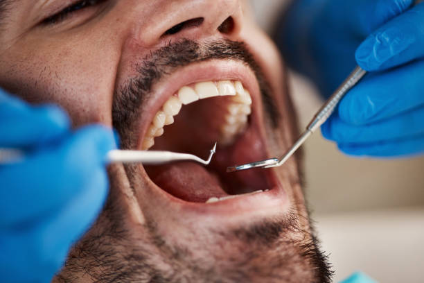 Best Cosmetic Emergency Dentistry in New Sarpy, LA